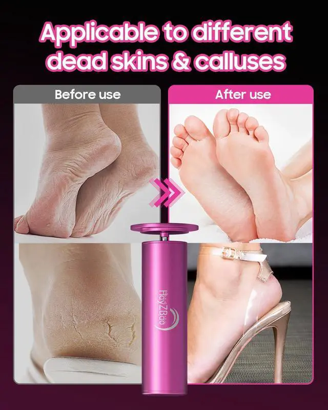 Alt view image 5 of 7 - _Mega Brand Foot Callus Remover - Electric Callus Remover for Feet,Adjustable Speed Foot Scrubber with 60 Pcs Sandpaper Discs,Professional Pedicure Tool for Dead Skin and Calluses - Matte Purple