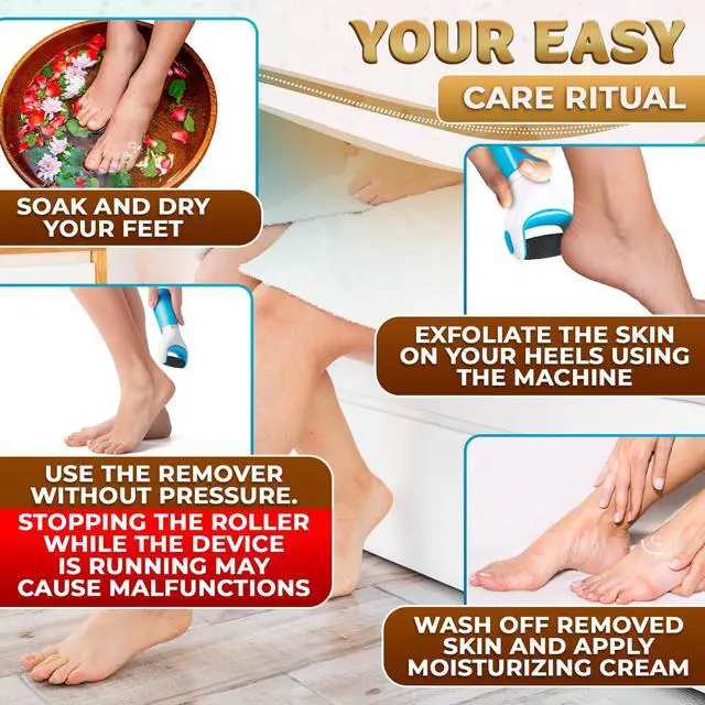 Alt view image 6 of 7 - _Mega Brands Foot Callus Remover Tool | Batteries Not Included High-Speed Foot Grinder with Easy-to-Replace Roller On-The-Go Electric Callus Remover for Feet | Pedicure Tools for Feet Smoothing
