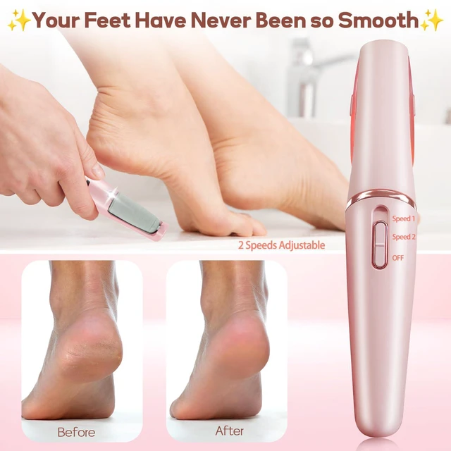 Alt view image 3 of 7 - Callus Remover for Feet, Electric Foot Callus Remover Rechargeable Pedicure Tools Smooth Pedicure Wand Electronic Foot File, Feet Care for Removes Dry Hard & Dead Skin Ideal Gift