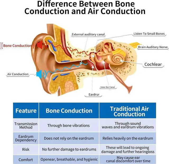 Alt view image 2 of 7 - Wireless Bone Conduction Headphones - 12H Playtime, Open-Ear Design, Individual Volume Adjustment