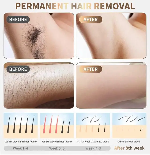 Alt view image 5 of 7 - Laser Hair Removal Device Home Use IPL Laser Beauty Device Laser Hair Removal for Women and Men Hair Remover with Painless Permanent for Whole Body,Facial Lip Bikini Line Armpit Back Leg Arm