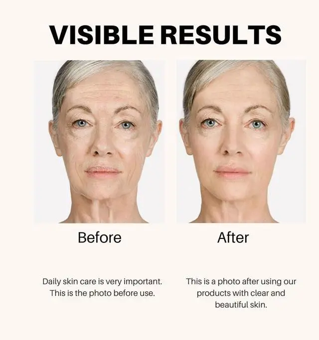 Alt view image 2 of 6 - Anti-Aging Lifting & Firming Cream  Hydrating & Tightening Formula for All Skin Types  Paraben-Free, Fragrance-Free, BHA-Free (1.7 fl oz / 50 ml)