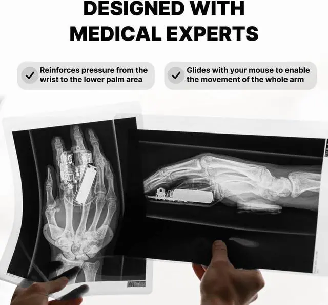 Alt view image 5 of 7 - FOR-Carpio 2.0 - Right-Handed Truly Ergonomic Wrist Rest for Mouse, Carpal Tunnel Support, Pain Relief, Anti-Fatigue, Easy Glide, Sleek, Office, Computer, Laptop, Gaming - Large, Black