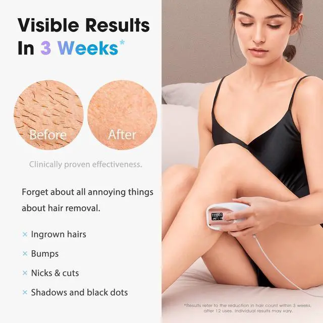 Alt view image 2 of 7 - IPL Laser Hair Removal Device for Women & Men - Home 45°F Ice-Cooling Contact for Painless & Long-Lasting Results, 86% Hair Reduction in 3 Weeks for Full Body & Bikini Line, Rose Gold