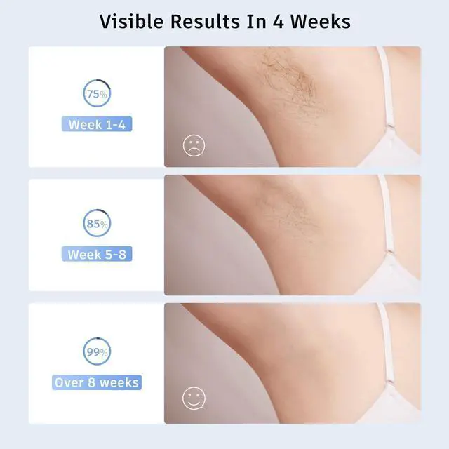 Alt view image 4 of 7 - Laser Hair Removal,Laser Hair Removal for Women, 999999 Flashes,Hair Removal Device,ipl laser hair removal for Facial Legs Arms Whole Body Use (White-Rose Gold)