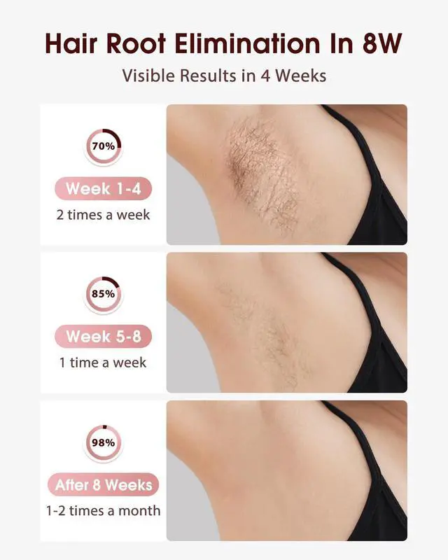 Alt view image 2 of 7 - Laser Hair Removal, IPL Hair Removal with Ice-Cooling System for Painless & Long-Lasting Result, Safe At-Home Hair Remover Device for Armpits Back Legs Arms Face Bikini Line, Rose Gold