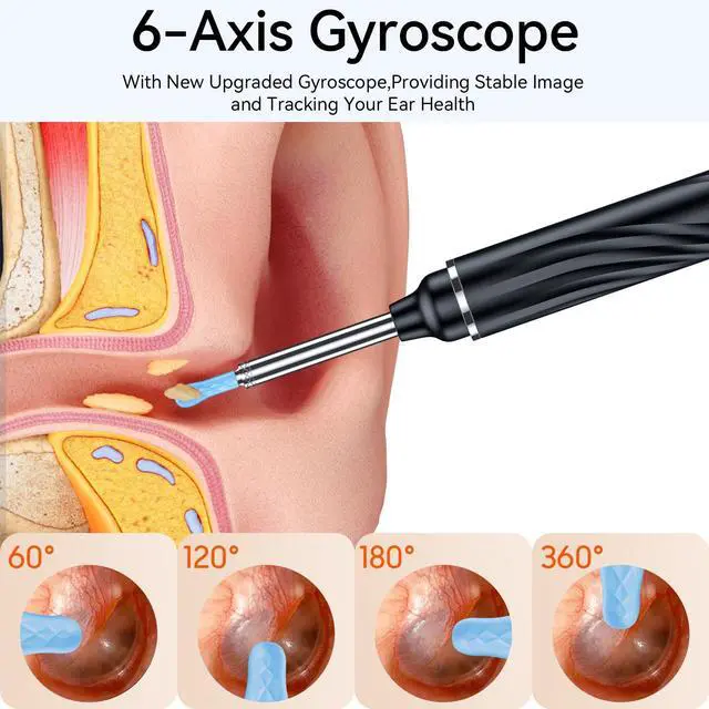 Alt view image 6 of 7 - Tomaje Ear Wax Removal Tool Camera, Earwax Removal Tools, Earwax Remover, Ear Wax Scooper, Ear Cleaner with Camera, 1080P HD Ear Camera and 6 LED Light, 6 Ear Pick & Ear Set for iOS & Android, Black