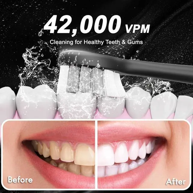 Alt view image 6 of 7 - Diamond Style - Sonic Electric Toothbrush for Adults and Kids, Comes with 10 Brush Heads & Travel Case, 5 Modes with 2 Minutes Built in Smart Timer, One Charge for 90 Days, 42,000 VPM Motor (Black)