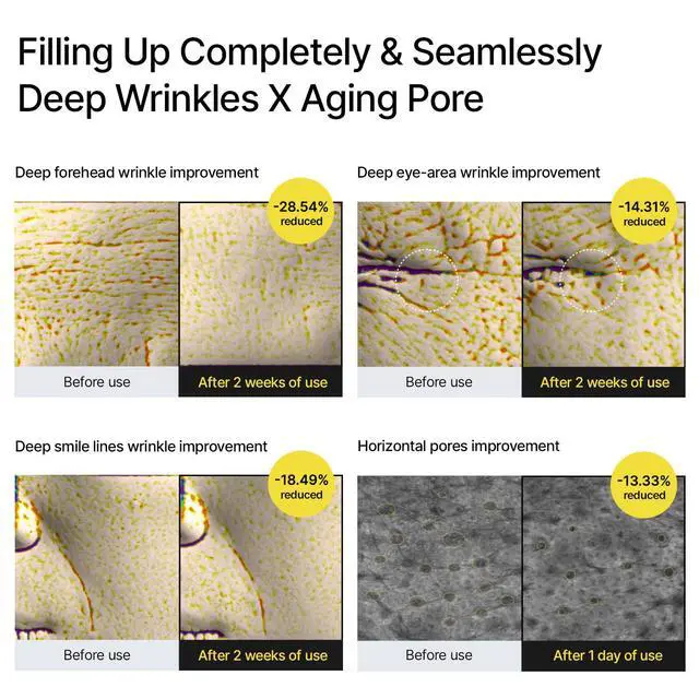 Alt view image 5 of 7 - The Vita A Retinal Shot Tightening Booster | 0.1% Retinal, 3% Matryxyl, High-Strength Retinoid for Anti-Aging, Pore Minimizer, Wrinkles & Fine Lines, Firmer Skin, 15ml, Korean Skin Care Gift