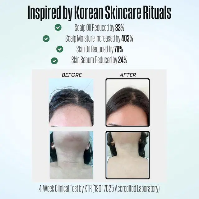 Alt view image 3 of 7 - POSEION BT100 DG Filtered Shower Head  Handheld, High Pressure, Magnetized Sediment Filter, Ultrafine Water Stream, Spa-Like Comfort, Durable Build, Made in Korea