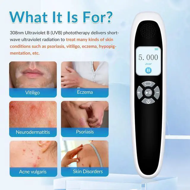 Alt view image 3 of 7 - ZJKC 6Diodes 308nm Excimer Blue Uvb Light therapy device for Skin Deseases Treatment