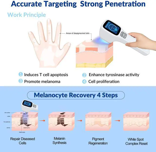 Alt view image 3 of 7 - ZJKC Touchscreen 49 Diodes Cold Laser Therapy Device For Pain Relief 650/808nm 905nm 980nm