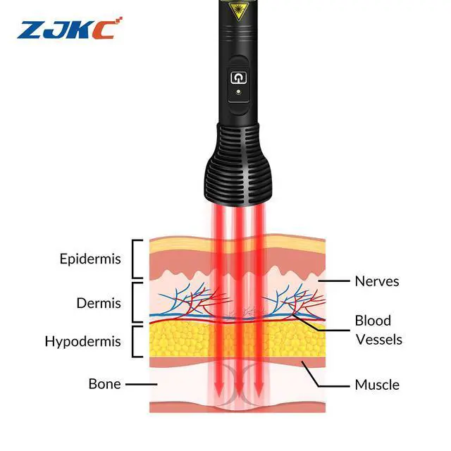 Alt view image 3 of 6 - ZJKC 1000mW 808nmx3 Cold Laser Red Infrared Light Therapy Pen for Pain Relief