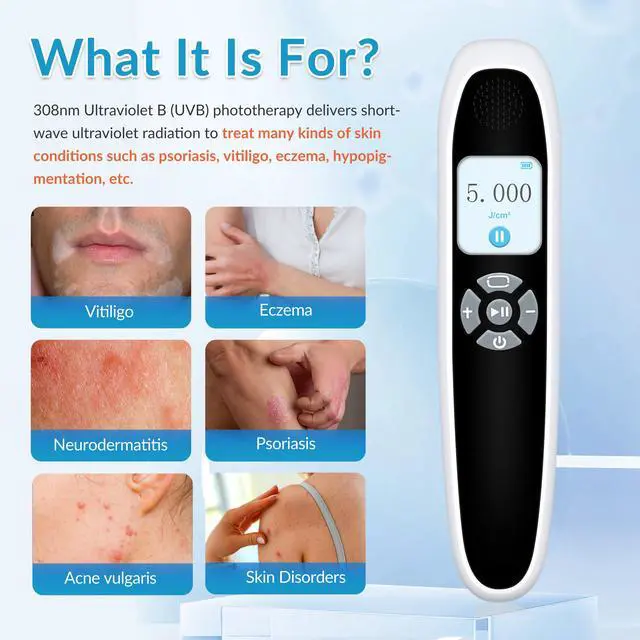 Alt view image 3 of 7 - ZJKC 308nm Excimer Home Phototherapy Device for Skin Diseases Uvb Light 20mW/cm2