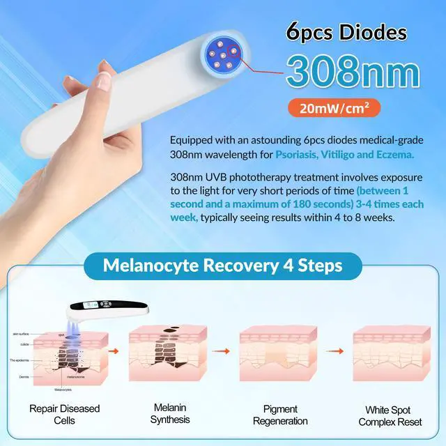 Alt view image 2 of 7 - ZJKC 308nm Excimer Home Phototherapy Device for Skin Diseases Uvb Light 20mW/cm2