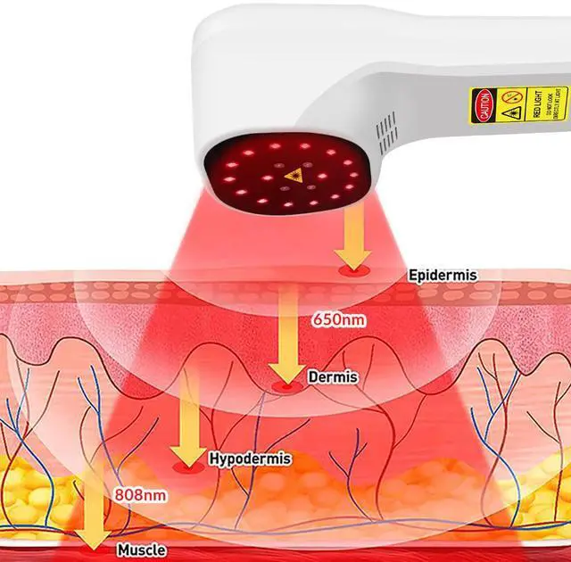 Alt view image 2 of 7 - ZJKC Class 4 Cold Laser Therapy Low Level Light Treatment for Pain Relief Device OFFE