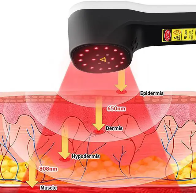 Alt view image 2 of 6 - ZJKC 880mW Low Level Laser Therapy Treatment Device for Pain Relief 650nm 808nm