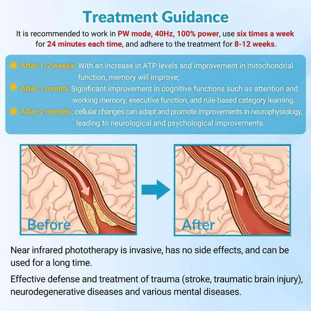 Alt view image 5 of 7 - ZJKC 1070nm Stroke Therapy Photobiomodulation PBM Helmet for Alzheimer Parkinson