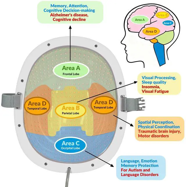 Alt view image 4 of 6 - ZJKC Home Use 810nm for Brain Helmet Parkinson's Disease Red Light Therapy Brain Fog