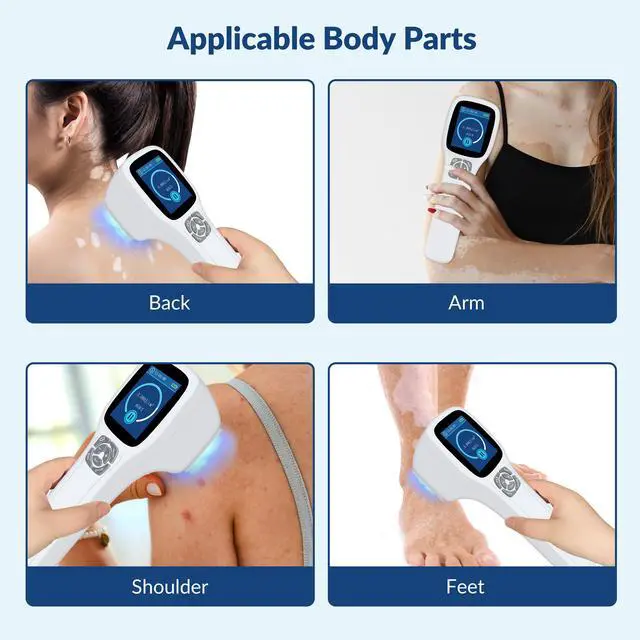 Alt view image 4 of 7 - ZJKC 308nm Excimer System Uv Light Treatment for Skin Disorders Therapy Device