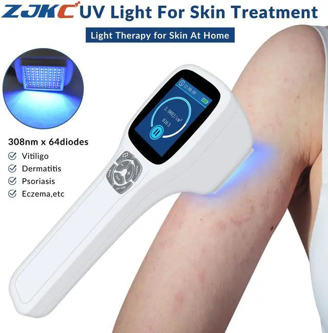 Main image of ZJKC 308nm Excimer Uvb Lamps Light Therapy Phototherapy Device for Skin Diseases