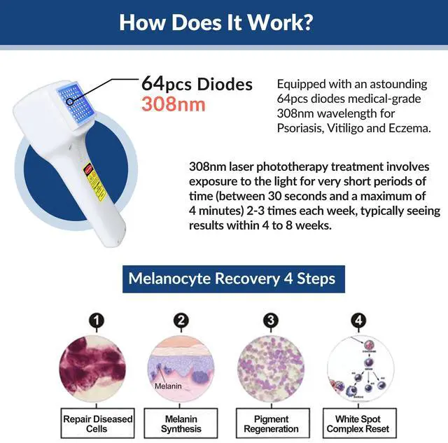 Alt view image 7 of 7 - ZJKC 308nm Excimer Uvb Lamps Light Therapy Phototherapy Device for Skin Diseases