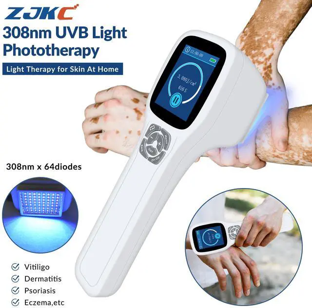 Main image of ZJKC 308nm Excimer Blue Light Therapy Phototherapy for Skin Diseases Device