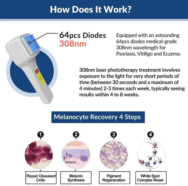 Alt view image 2 of 7 - ZJKC New 308nm Uvb Phototherapy Device UV Light Therapy Lamp for Body Skin Diseases