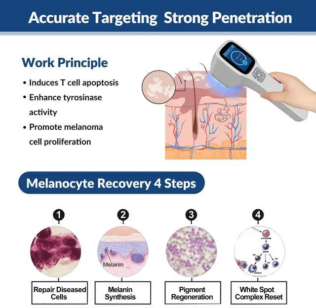 Alt view image 2 of 7 - ZJKC 308nm Light Treatment for Skin rejuvenation Lightening Blue Light Face Troubles