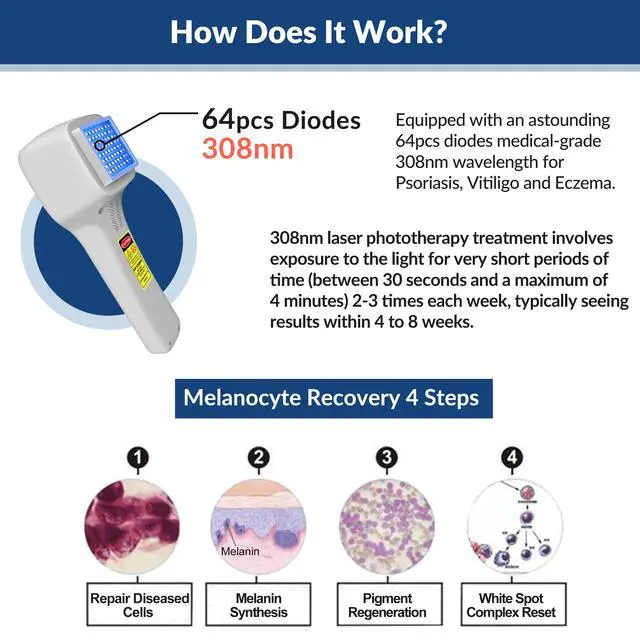 Alt view image 2 of 7 - ZJKC 308nm Phototherapy Lamp for Skin Treatment 49 Diodes UVB Light Therapy
