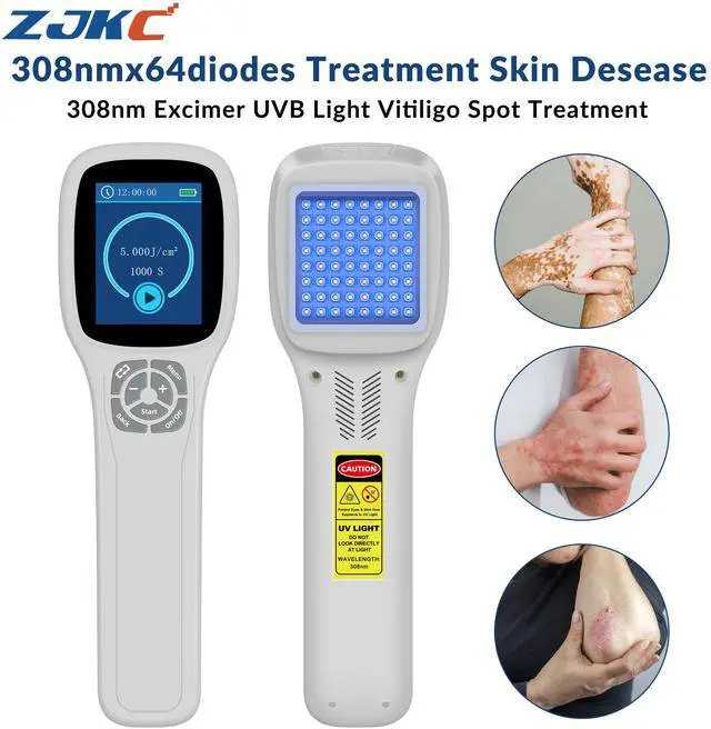 Main image of ZJKC 308nm Excimer UVB Light Therapy Device for Skin Diseases Treatment 49 Diodes