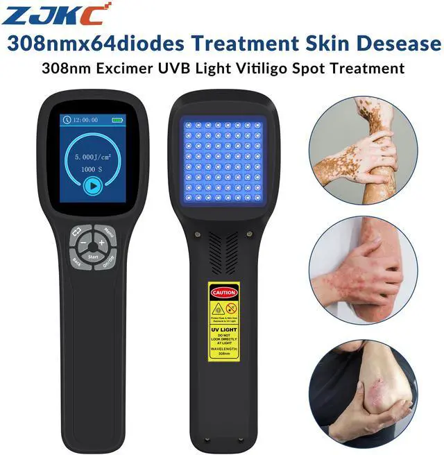 Main image of ZJKC 308nm Ultraviolet Light Treatment for Treatment UVB Lamp Phototherapy Device.