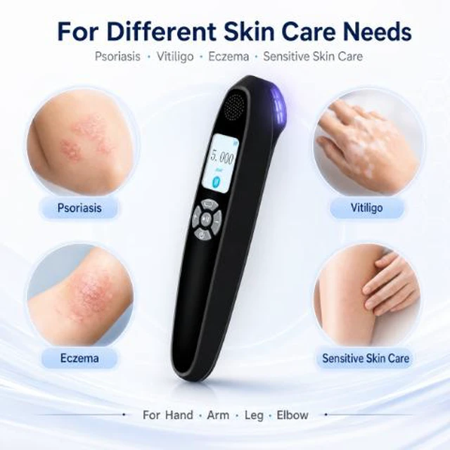 Alt view image 3 of 7 - ZJKC 308nm UVB Light Therapy Device 20mW/cm² for Psoriasis Vitiligo Eczema Portable Rechargeable LCD Home Phototherapy