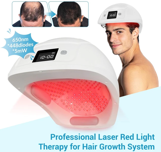 Main image of ZJK 2440mW Laser Hair Growth Cap 650nm Red Light Therapy Device 488 Laser Diodes Rechargeable LLLT Hair Regrowth Helmet for Men and Women Thinning Hair 1 Year Warranty