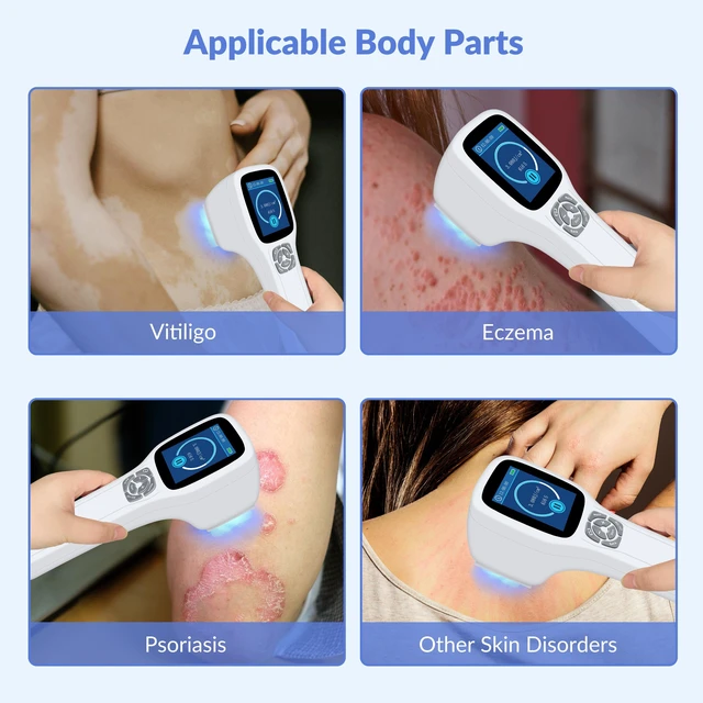 Alt view image 2 of 7 - ZJZKTOP 308nm UVB Light Therapy Device for Psoriasis and Vitiligo, Narrowband UVB Phototherapy Machine, 64 Diodes, Adjustable 5-50mW/cm2, Handheld Ultraviolet Therapy Lamp with MED Test