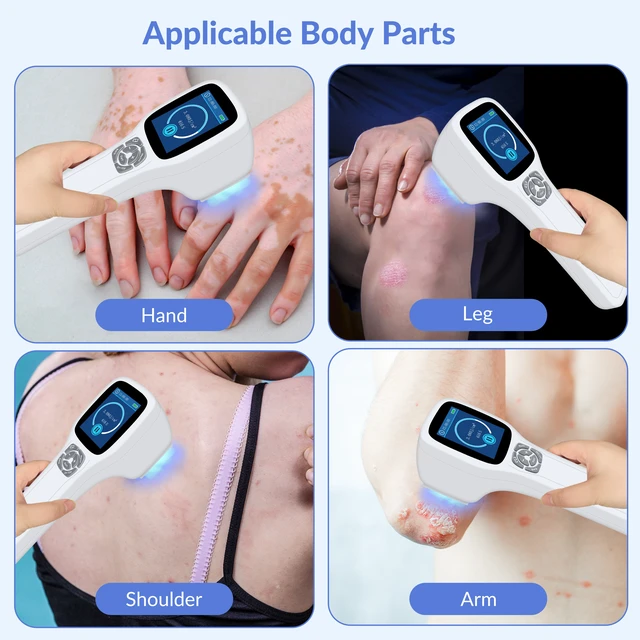 Alt view image 2 of 7 - ZJZKTOP 308nm UVB Phototherapy Device for Psoriasis Vitiligo, UVB Light Therapy Machine, 64 Diodes, 5-50mW/cm2 Adjustable Intensity, Ultraviolet Therapy Lamp with LCD Screen