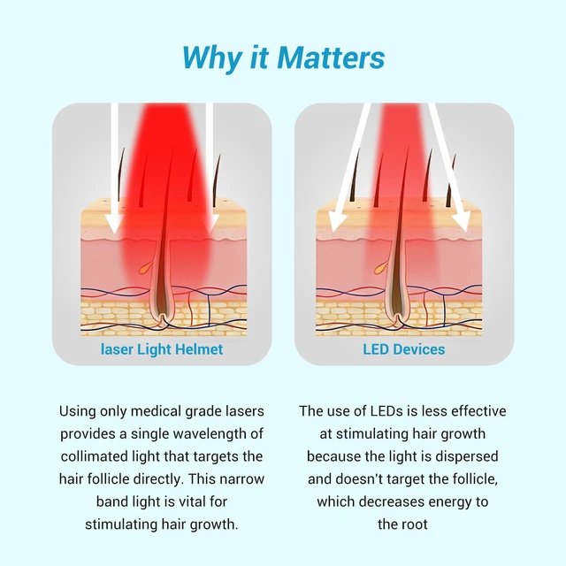 Alt view image 4 of 7 - ZJKC Laser Hair Growth Cap LCAP448, 448 Laser Diodes, 650nm Red Light, 2240mW, 7000mAh Battery, LCD Display, USB-C Charging, for Men and Women