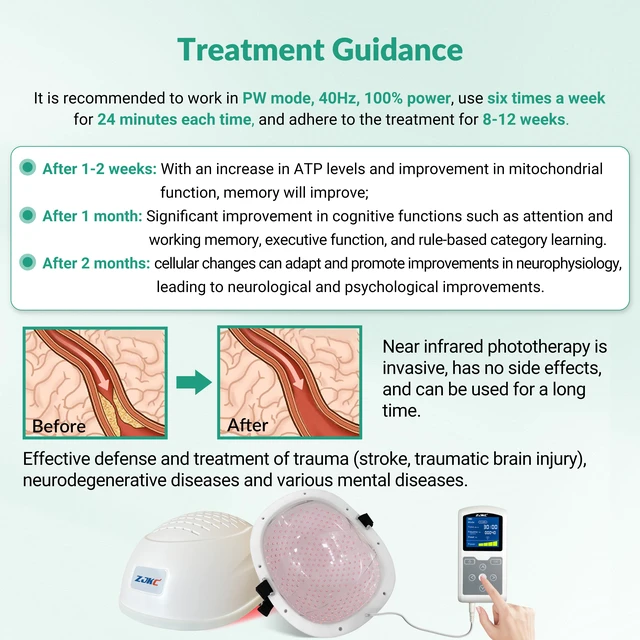 Alt view image 5 of 7 - ZJKC Infrared Light Therapy Helmet, 810nm Brain Photobiomodulation PBM Device, 280 LED Diodes, 15W Near Infrared Light, Adjustable 1-20000Hz Frequency, Rechargeable