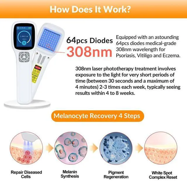 Alt view image 2 of 7 - Toponechoice 308nm Excimer Light High-intensity Ultraviolet Light for Skin Treatment 0-5J/cm2