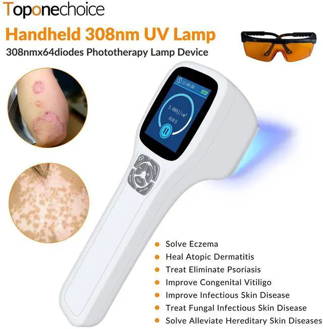 Main image of Toponechoice 308nm Excimer Light High-intensity Ultraviolet Light for Skin Treatment 0-5J/cm2