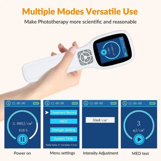 Alt view image 7 of 7 - Toponechoice 308nm Excimer Light High-intensity Ultraviolet Light for Skin Treatment 0-5J/cm2