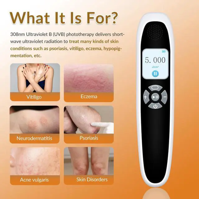 Alt view image 3 of 7 - Toponechoice Upgraded UVB Light Therapy Device, 308nm with Timer for Face/Body 0-5J/cm²