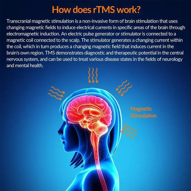 Alt view image 3 of 7 - Toponechoice RTMS Therapy Treatment Accessory-Ideal for Alzheimer Diseases Support & Memory