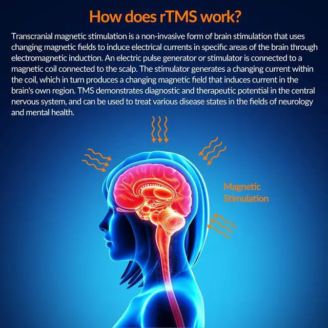 Alt view image 3 of 7 - Toponechoice tms for treatment resistant depression,bipolar disorder,bio magnetic healing,magnet therapy for horses
