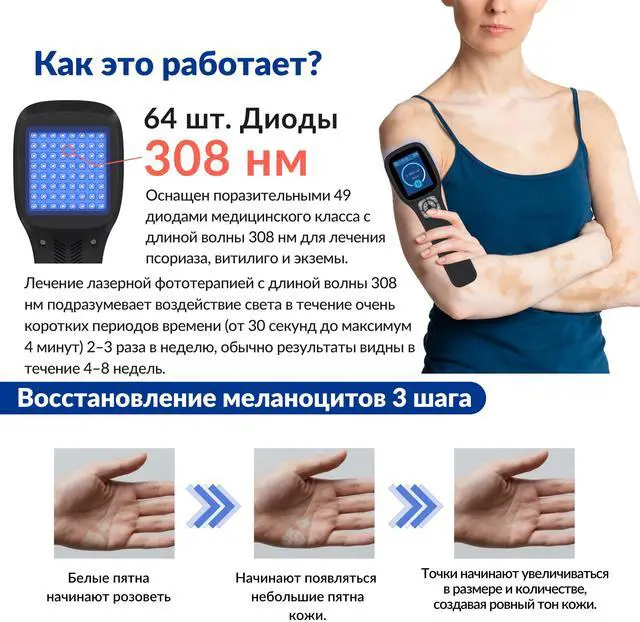 Alt view image 5 of 7 - Toponechoice psoriatic arthritis ultraviolet light therapy remedy for white patches on skin,small white dot on lip