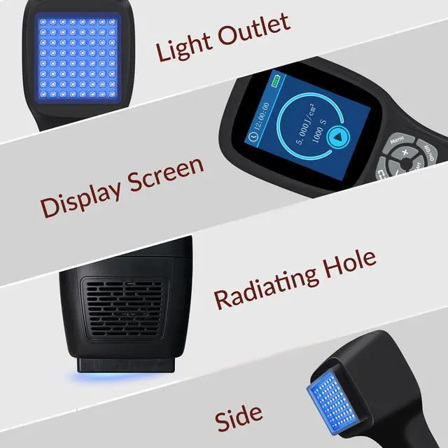 Alt view image 5 of 7 - Toponechoice phototherapy uv light home remedies for vitiligo on hands white marks on skin