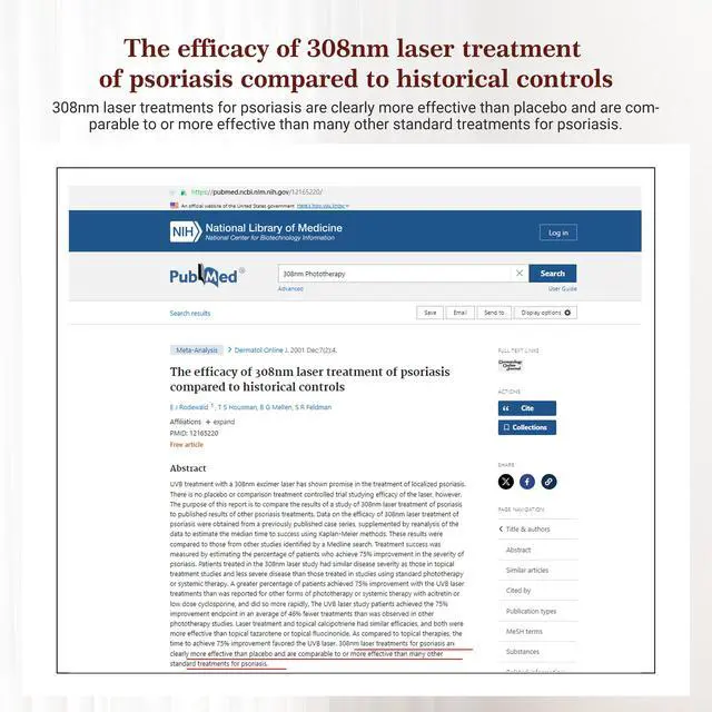 Alt view image 7 of 7 - Toponechoice home uvb phototherapy, narrowband uvb phototherapy, milia face, white marks on gums