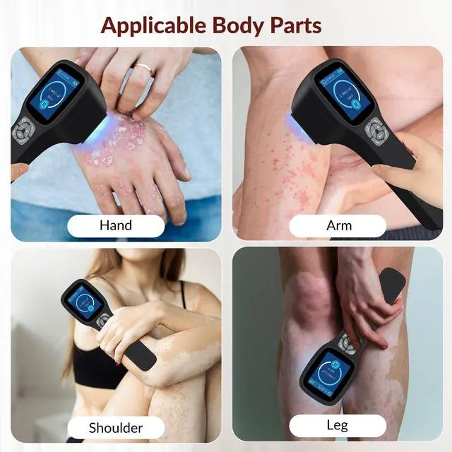 Main image of Toponechoice uv light therapy for wrinkles, therapy, derma roller for vitiligo, lips white patches, white marks on face