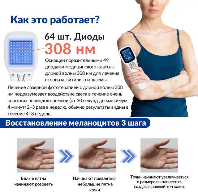 Alt view image 3 of 7 - Toponechoice uv light for skin treatment, dermatitis, cure for white spots on face, small white patches on skin