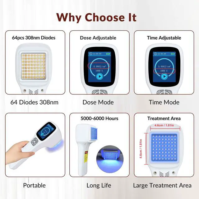 Alt view image 5 of 7 - Toponechoice 308 nm uv light good for skin remedy for white patches on skin back of throat white spots